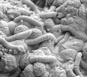 electron-microscope-view-of-bacteria